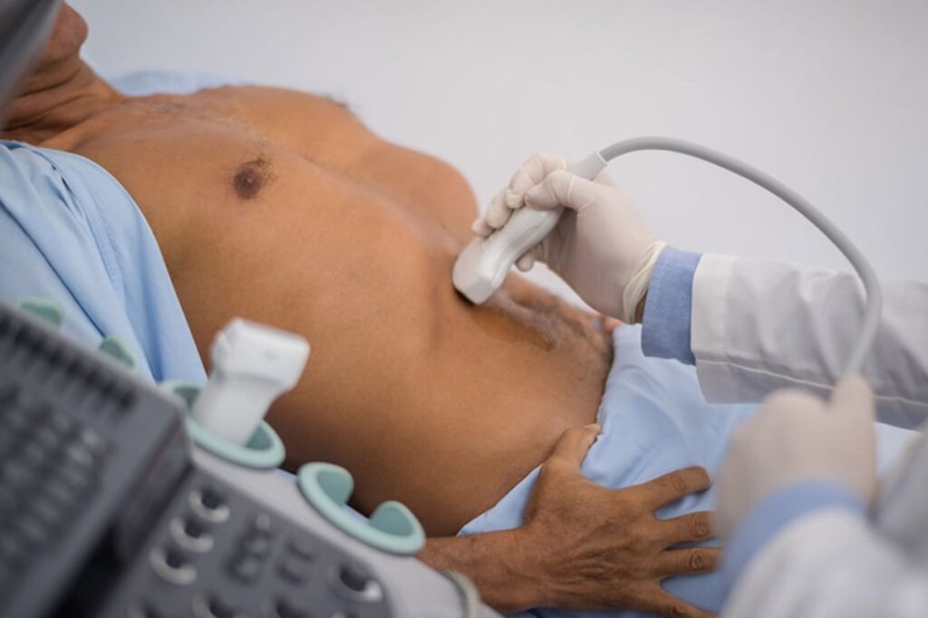 Ultrasonografia (USG)