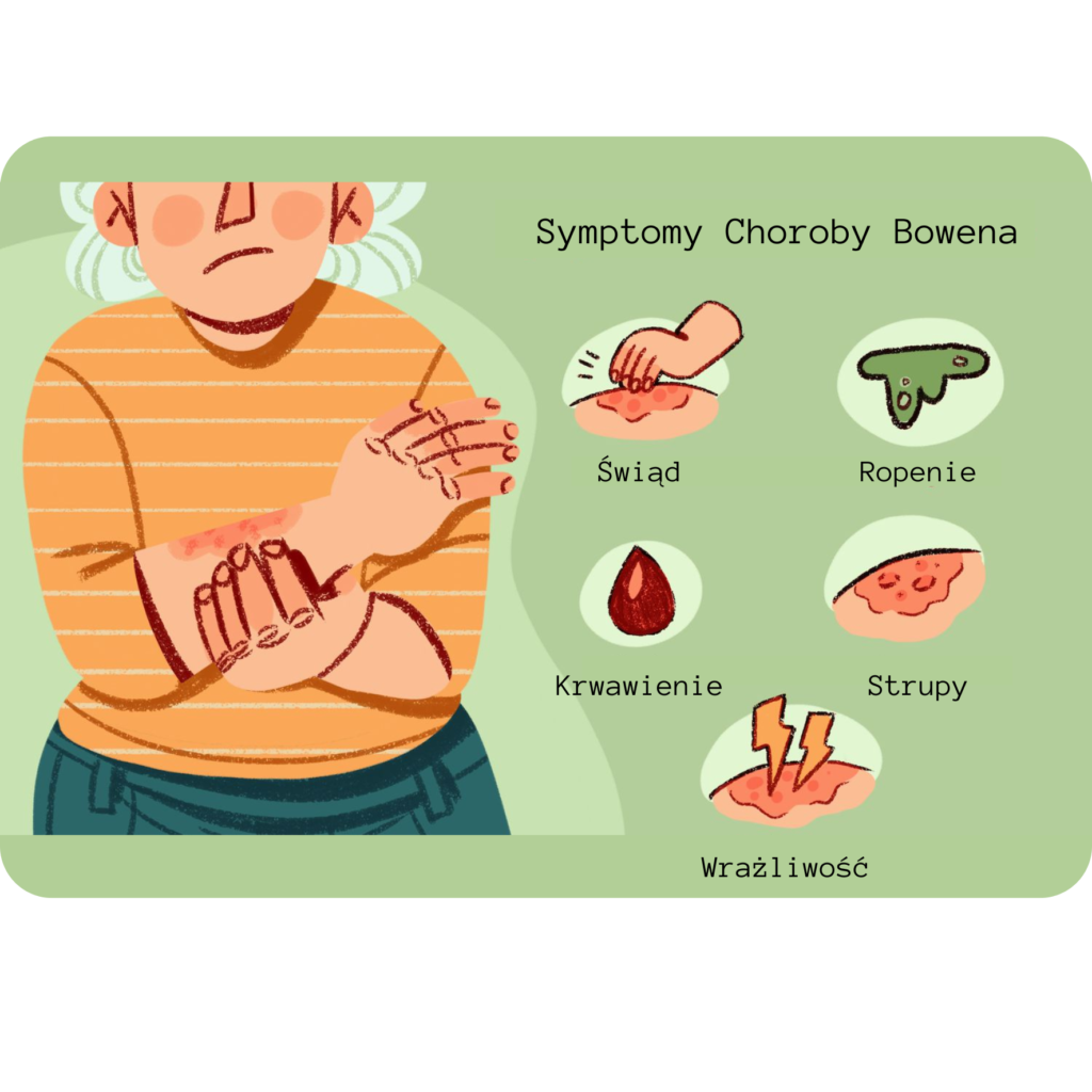 Symptomy Choroby Bowena