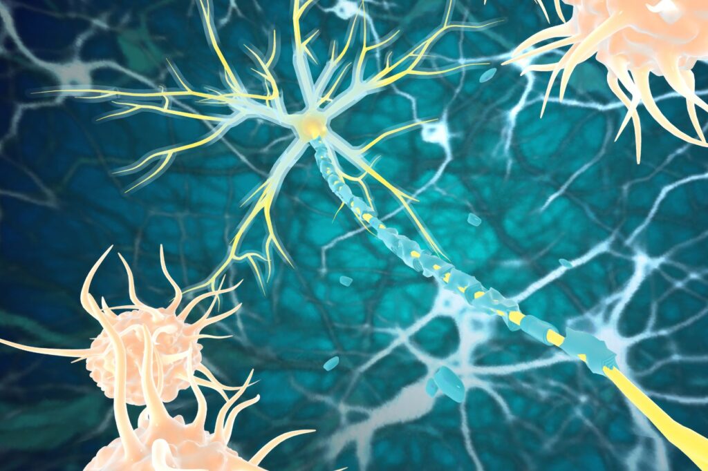 choroba autoimmunologiczna