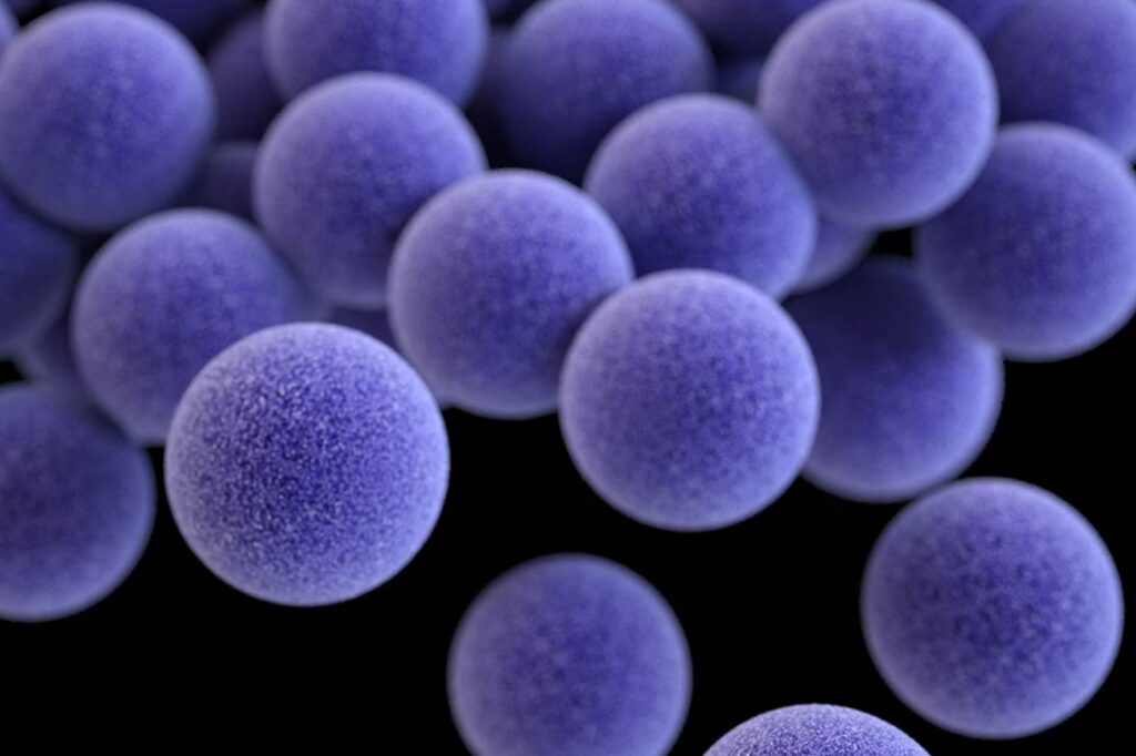 Czyrak_bakteria Staphylococcus aureus