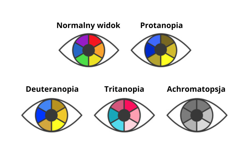 Rodzaje Daltonizmuv