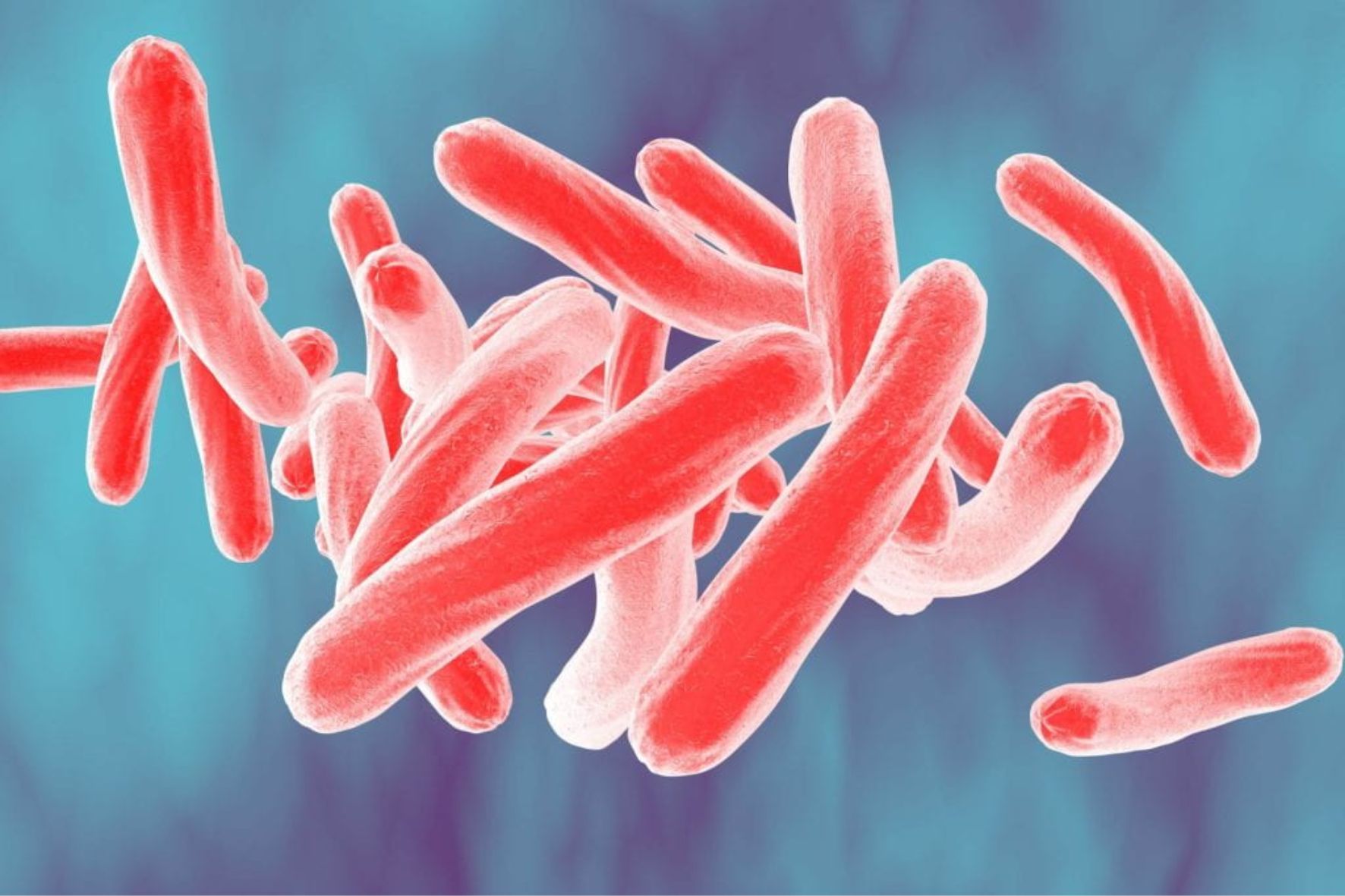 Gruźlica pierwotna - Mycobacterium tuberculosis