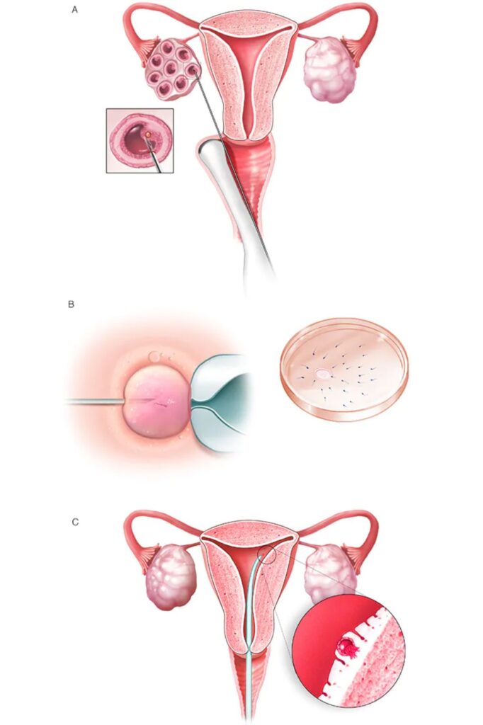 In vitro