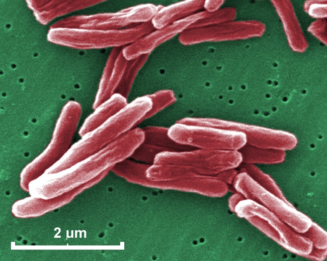 Mycobacterium tuberculosis