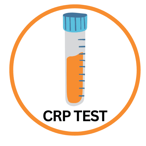 Odczyn białka C-reaktywnego (CRP)