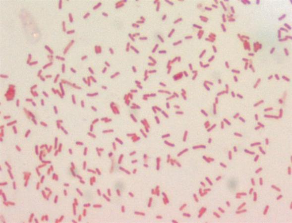 Yersinia pestis