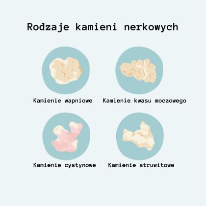 Rodzaje kamieni nerkowych