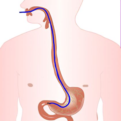 Biopsja jelita