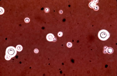 Cryptococcus neoformans