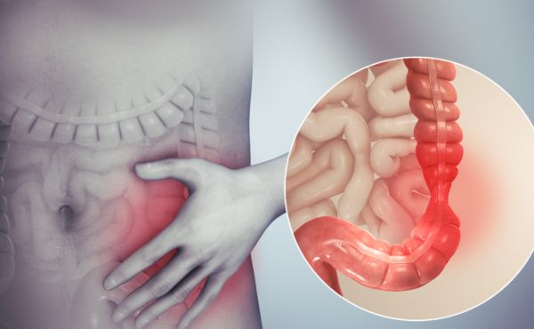 Zespół jelita drażliwego (IBS)