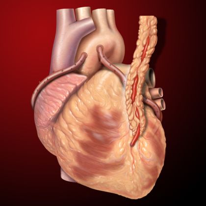 Bajpas aortokoronarny