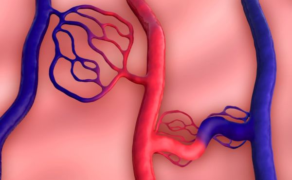 Malformacje tętniczo-żylne