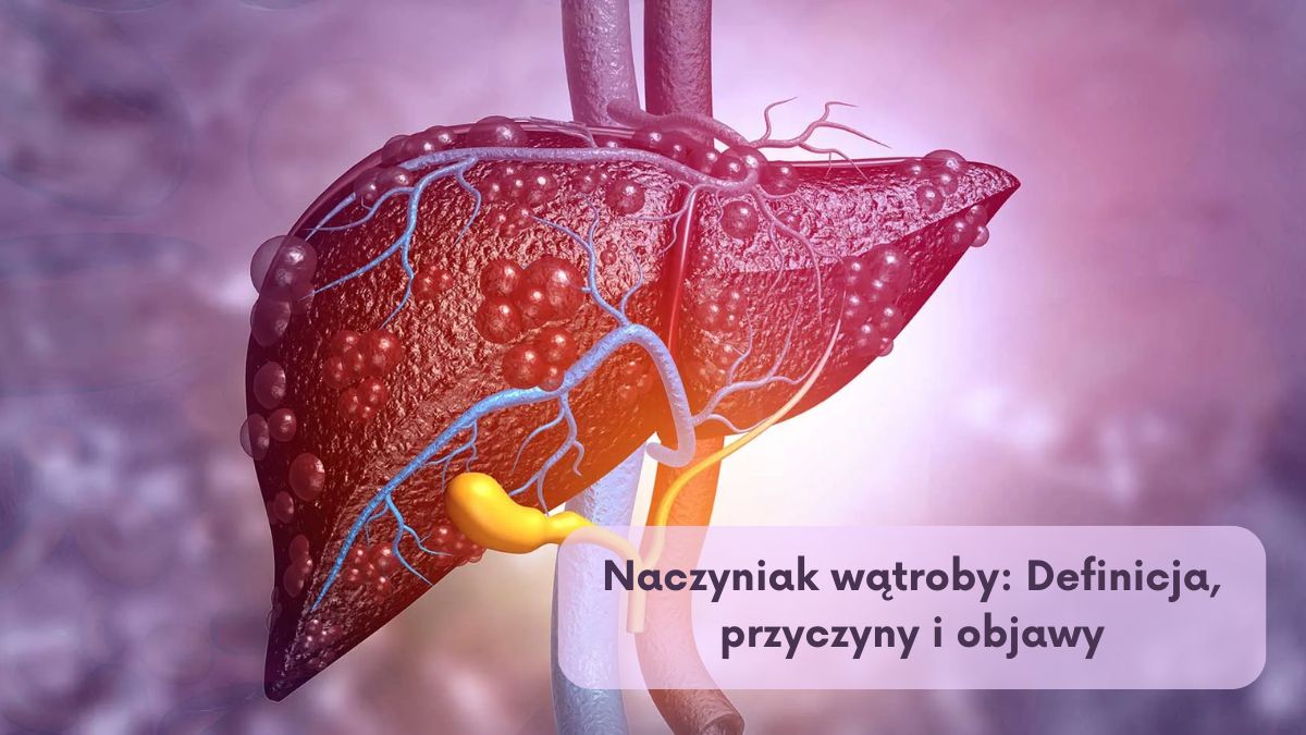 Naczyniak wątroby: Definicja, przyczyny i objawy