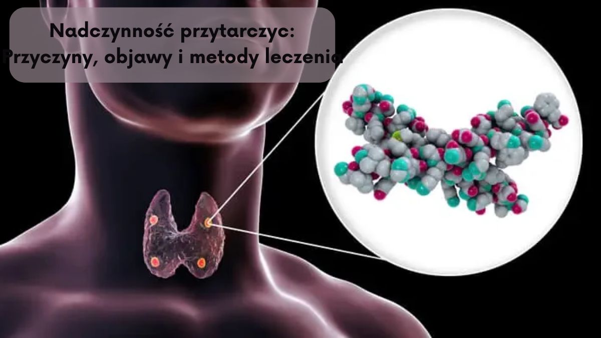 Nadczynność przytarczyc: Przyczyny, objawy i metody leczenia