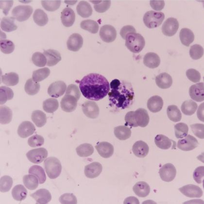 Plasmodium falciparum