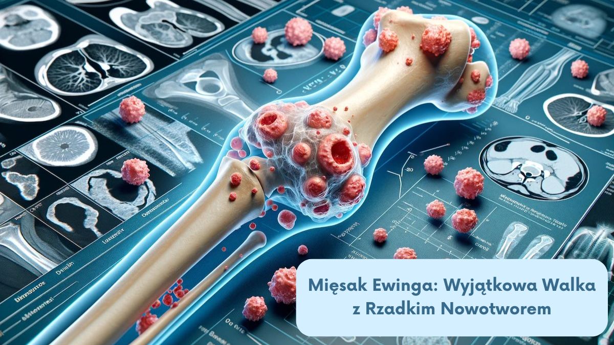 Mięsak Ewinga: Wyjątkowa Walka z Rzadkim Nowotworem