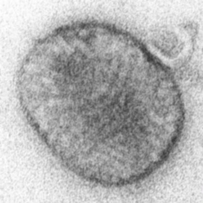 Molluscipoxvirus