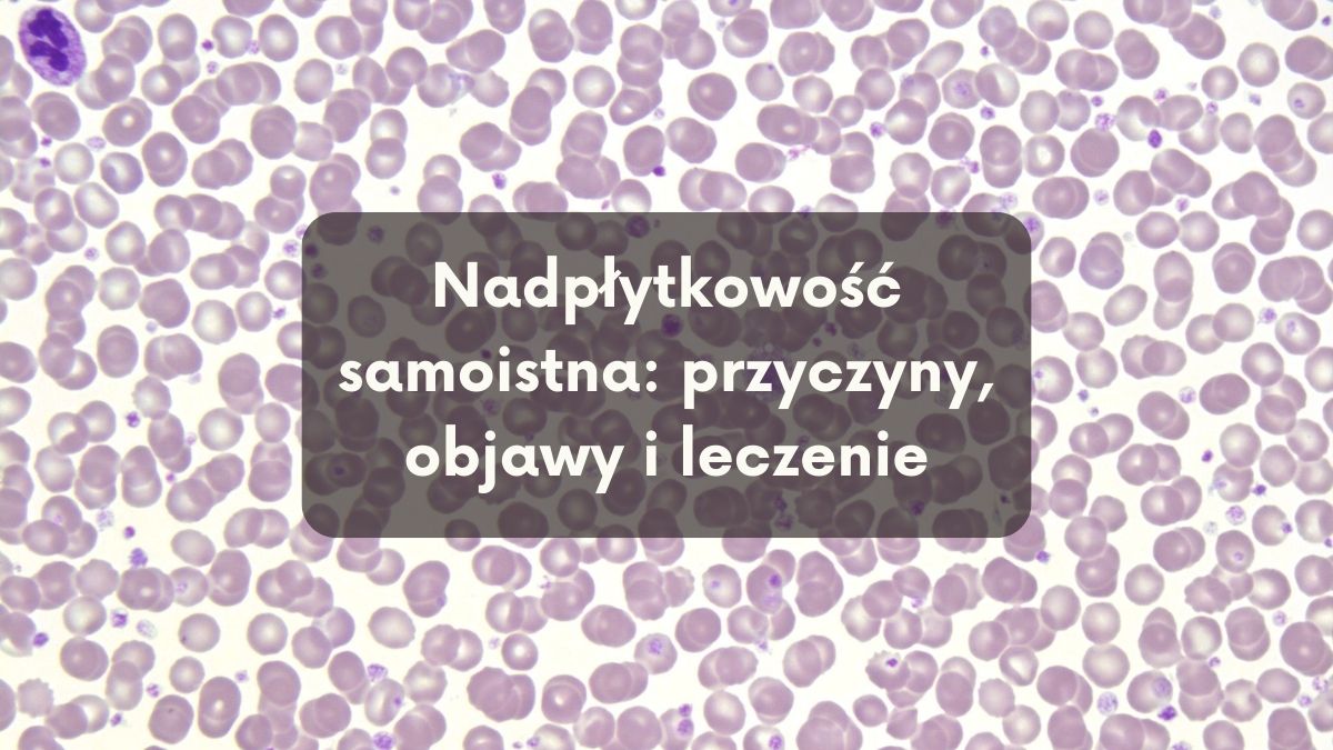 Nadpłytkowość samoistna: przyczyny, objawy i leczenie