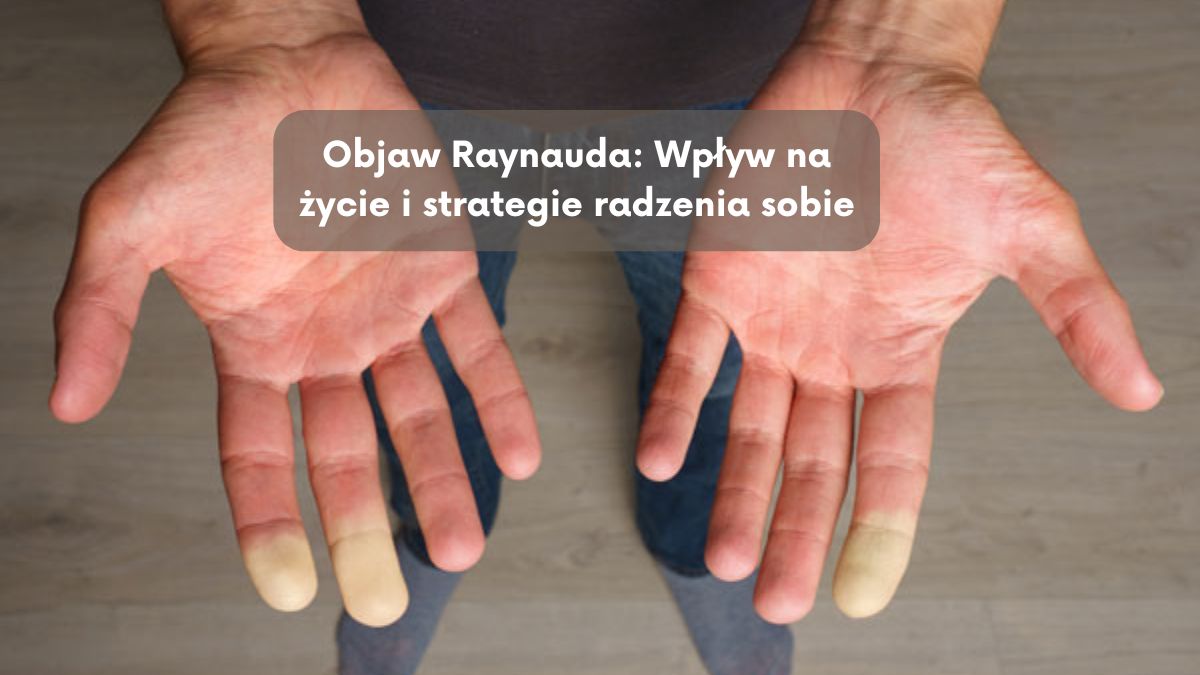 Objaw Raynauda: Wpływ na życie i strategie radzenia sobie