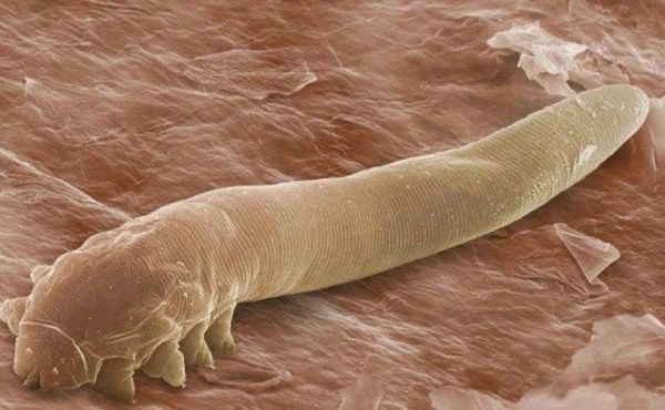 Roztocza Demodex