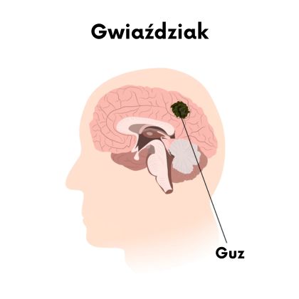 Gwiaździaki