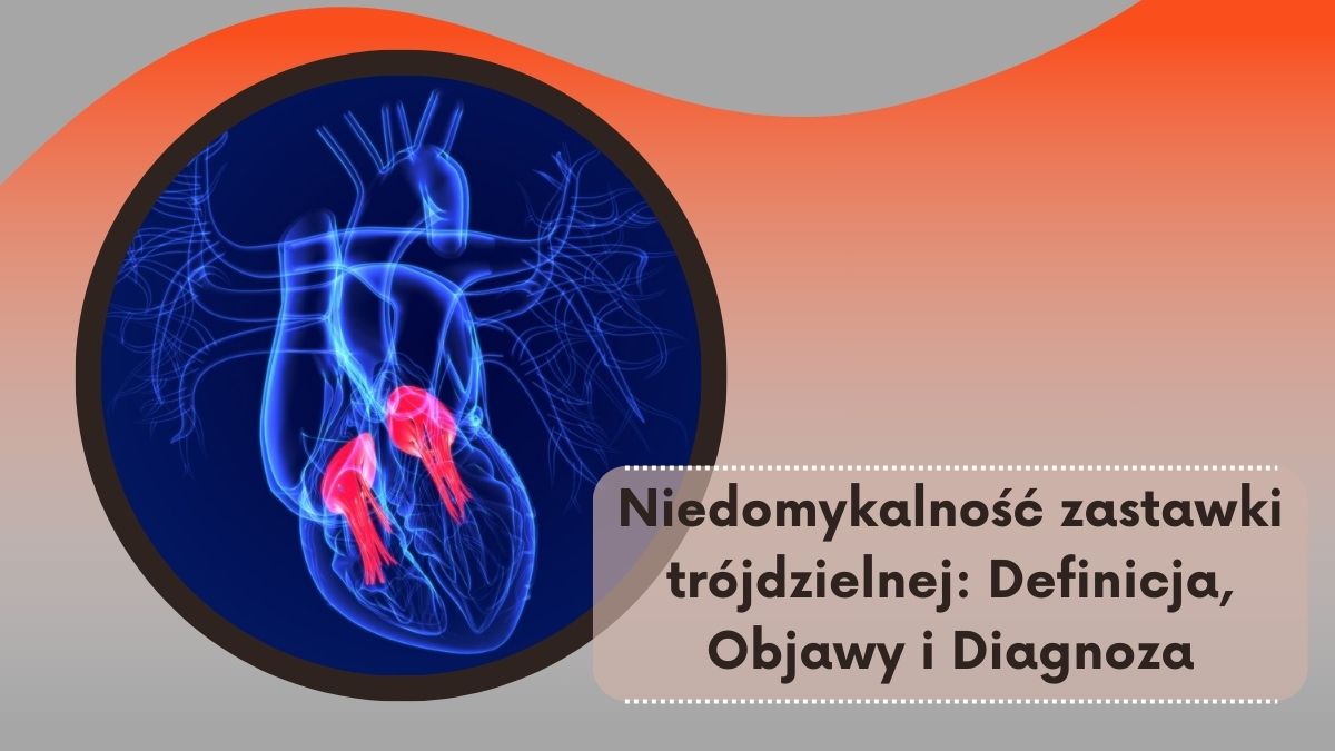 Niedomykalność zastawki trójdzielnej: Definicja, Objawy i Diagnoza