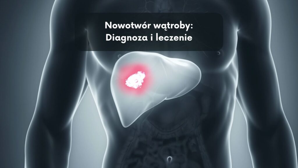 Nowotwór wątroby: Diagnoza i leczenie