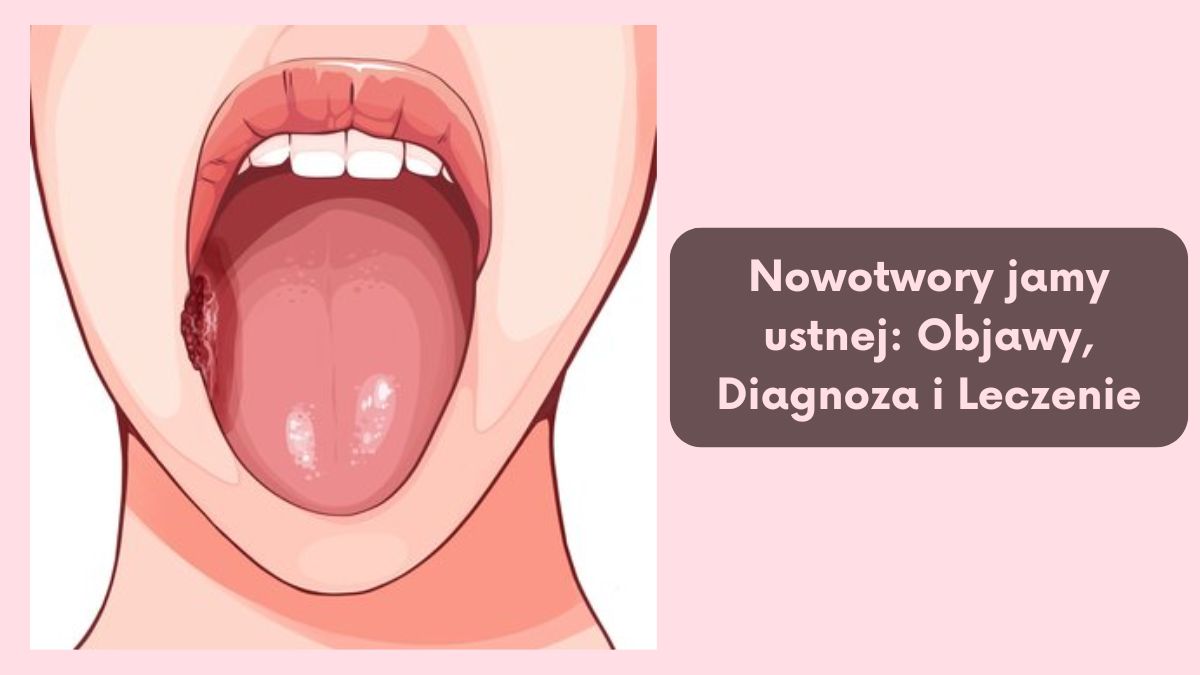 Nowotwory jamy ustnej: Objawy, Diagnoza i Leczenie