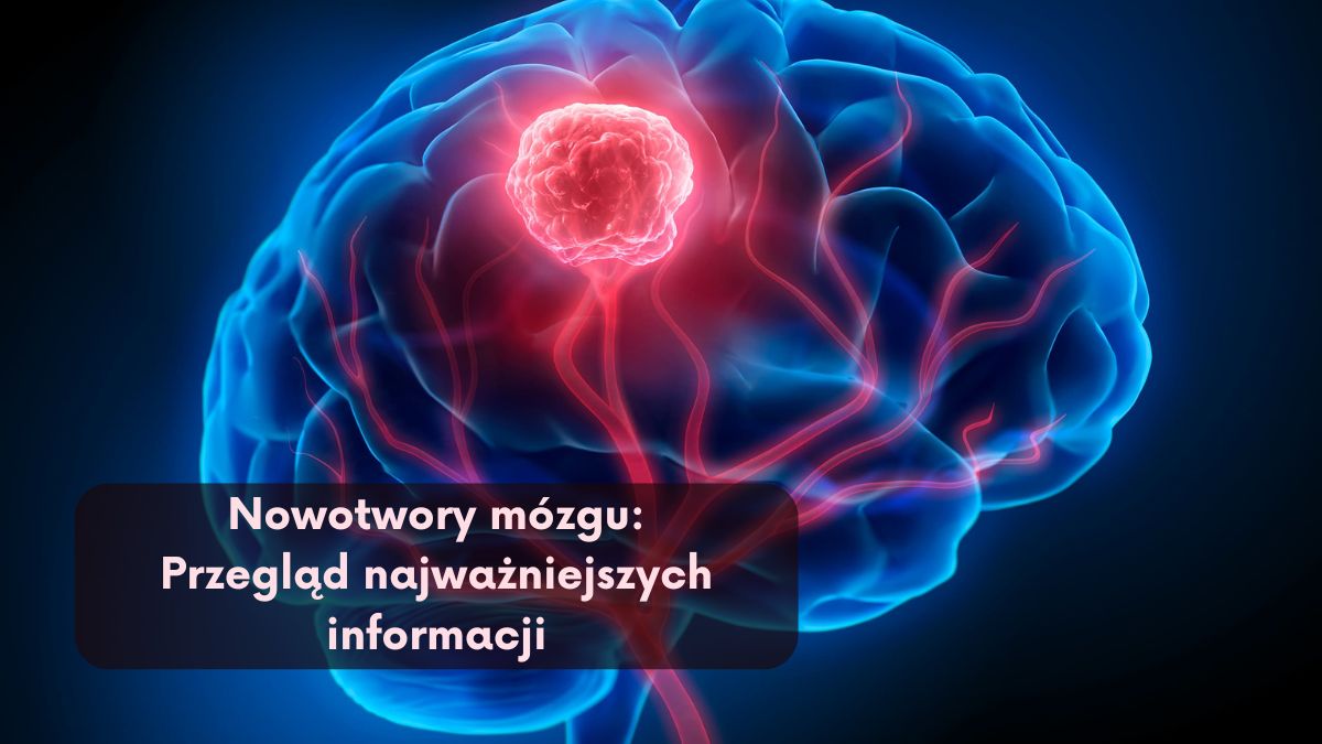 Nowotwory mózgu: Przegląd najważniejszych informacji