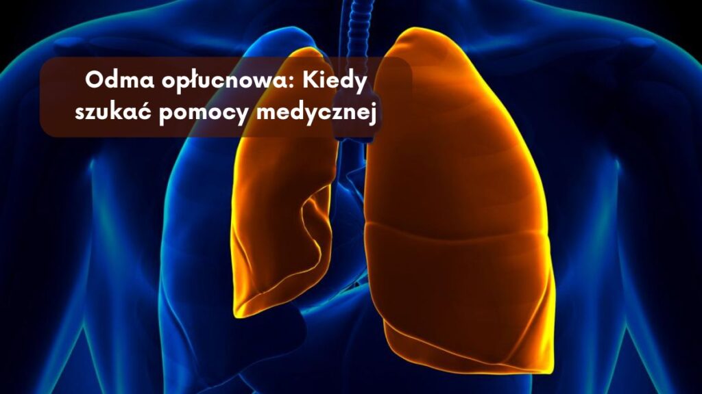 Odma opłucnowa: Kiedy szukać pomocy medycznej