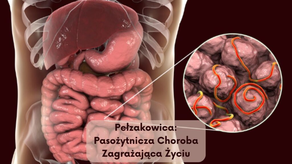 Pełzakowica: Pasożytnicza Choroba Zagrażająca Życiu